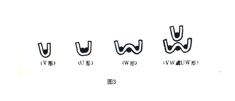 燈芯絨絨毛固結(jié)方式